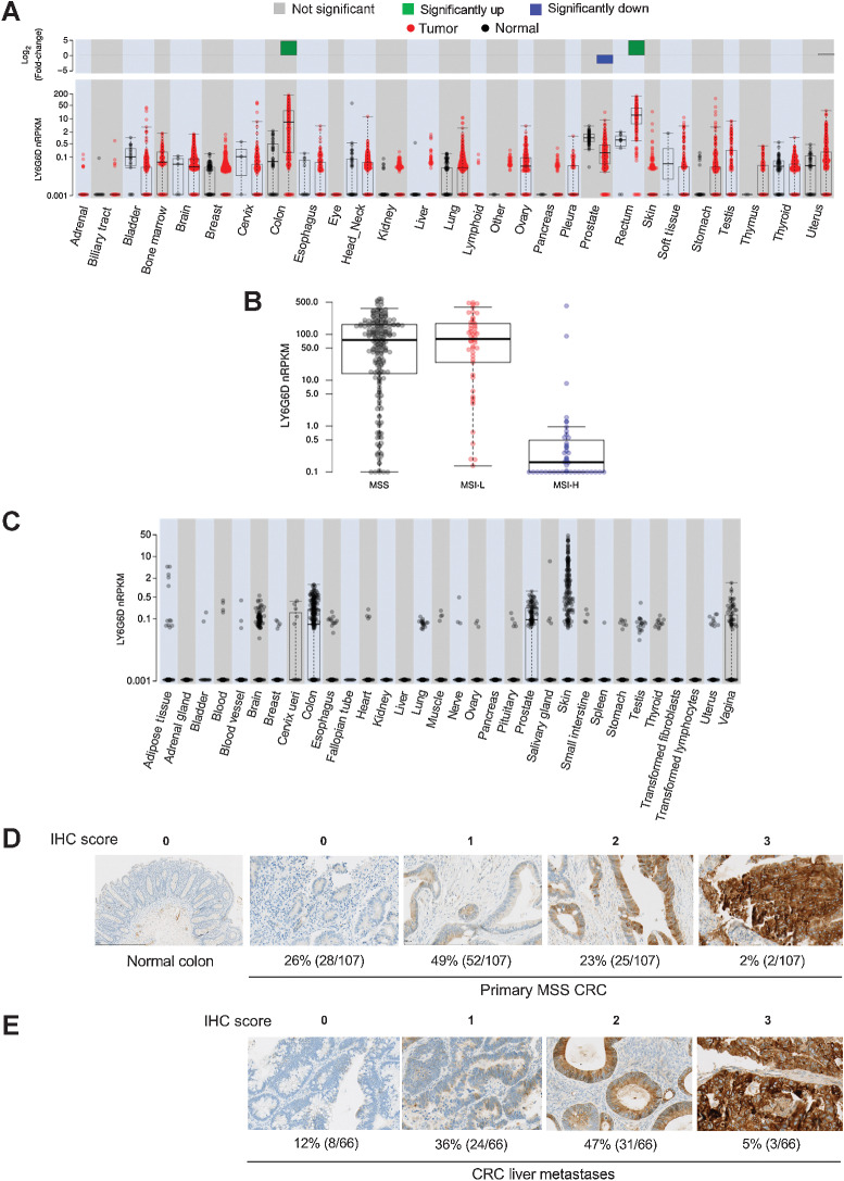 Figure 1. LY6G6D is differentially overexpressed in colorectal cancer. A, LY6G6D differential expression in samples in TCGA RNA-seq dataset. Gene expression is displayed in normalized Reads Per Kilobase of exon model per Million mapped reads (nRPKM). B, LY6G6D expression in MSS/MSI-L/MSI-H colorectal cancer samples in TCGA dataset. MSS: n = 108; MSI-L: n = 36; MSI-H: n = 35. C, LY6G6D expression in human normal tissue samples in the GTEx RNA-seq dataset. A–C, Boxes represent the IQR, the horizontal line is the median. Whiskers extend to the most extreme data point that is within 1.5*IQR of the 25th and 75th percentiles. Data points beyond the whiskers represent outliers. D, Representative images of LY6G6D IHC staining in normal colon and primary MSS colorectal cancer samples (n = 107). E, Representative images of LY6G6D IHC staining in colorectal cancer liver metastases (n = 66). Numbers of positive samples under each IHC score are derived at tumor cell expression cutoff of 50%, which requires that at least 50% of the tumor cells stained positive for LY6G6D at the denoted levels. IHC score: 0 = negative; 1+ = low signal; 2+ = moderate signal; 3+ = strong signal.