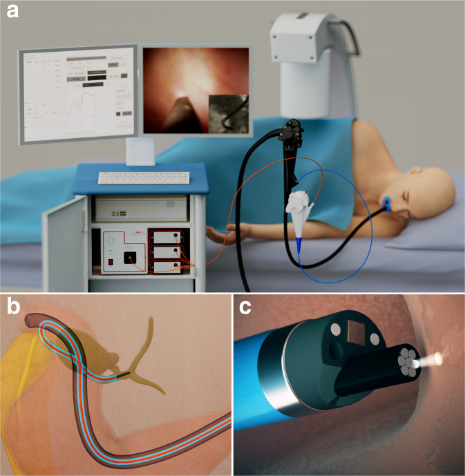 Fig. 1