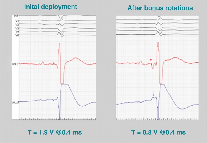 Figure 9