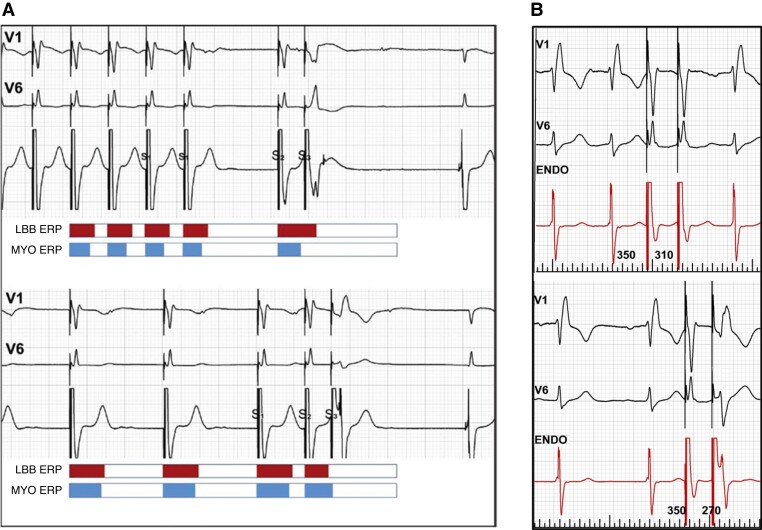 Figure 23