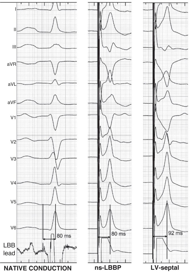 Figure 24