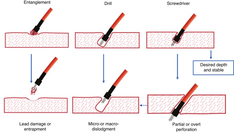 Figure 16