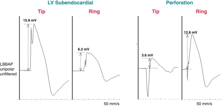 Figure 28