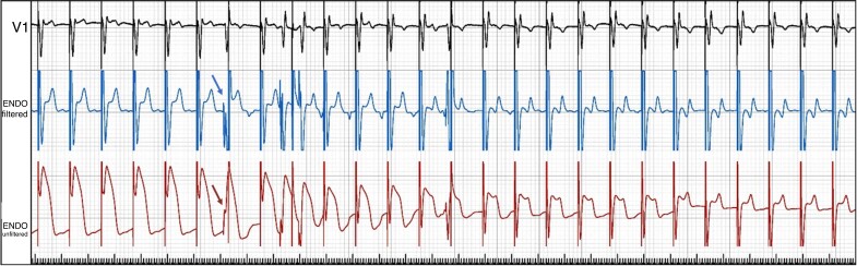 Figure 19