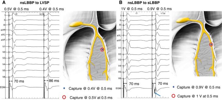 Figure 22