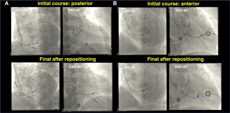 Figure 15