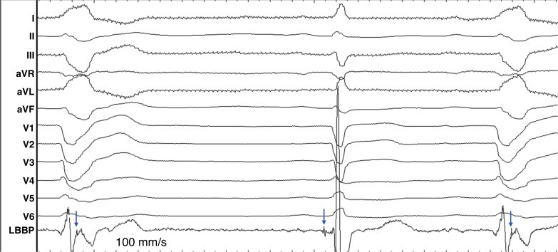 Figure 20