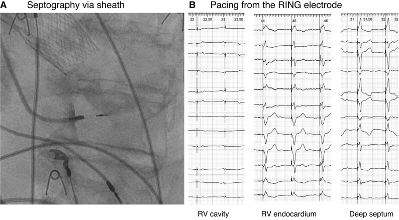 Figure 21