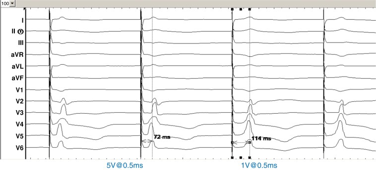 Figure 26