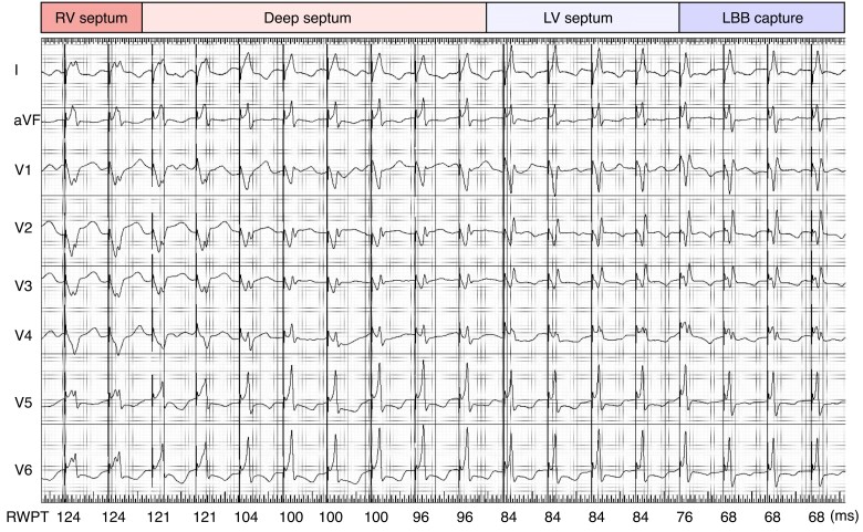 Figure 17