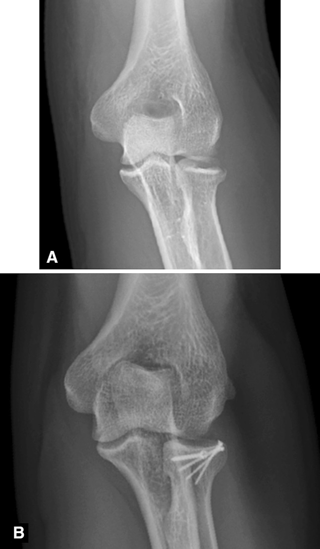 Fig. 1A–B