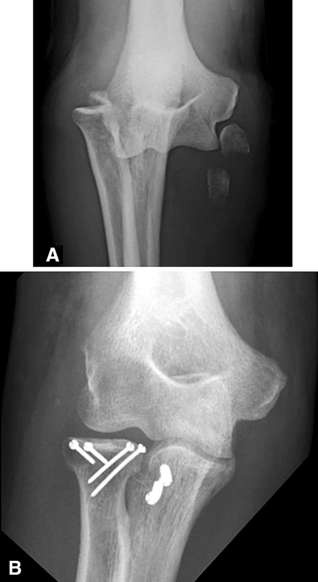 Fig. 2A–B