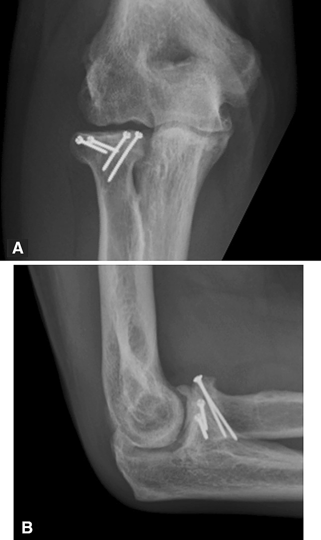 Fig. 3A–B