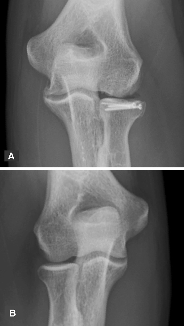 Fig. 4A–B