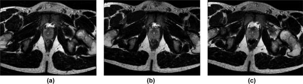 Fig. 13