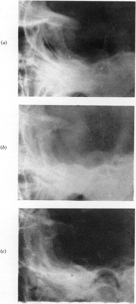 Fig. 14