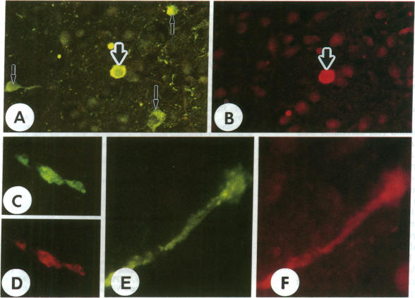 graphic file with name pnas01041-0330-a.jpg