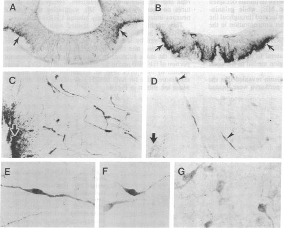 graphic file with name pnas01041-0328-a.jpg