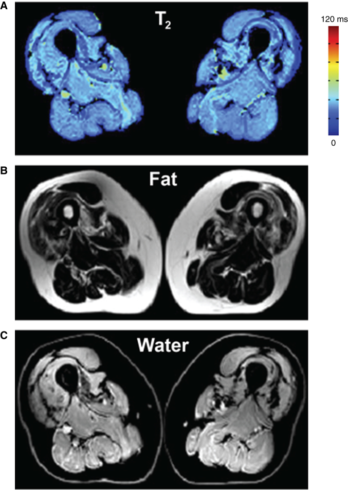 Fig.1