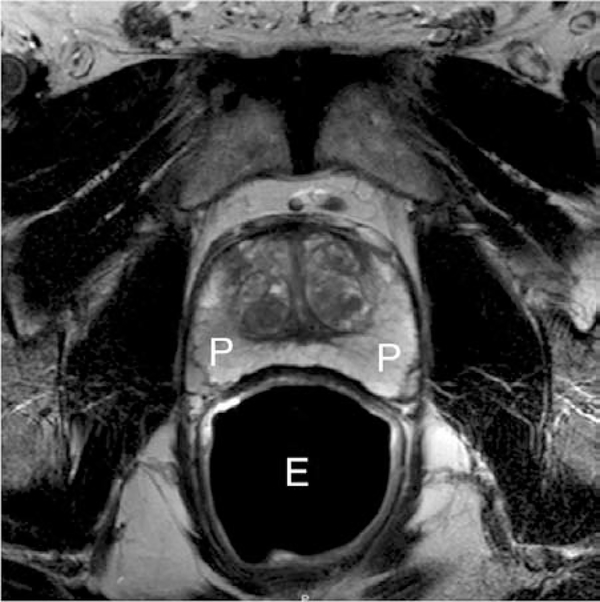 Figure. 1.