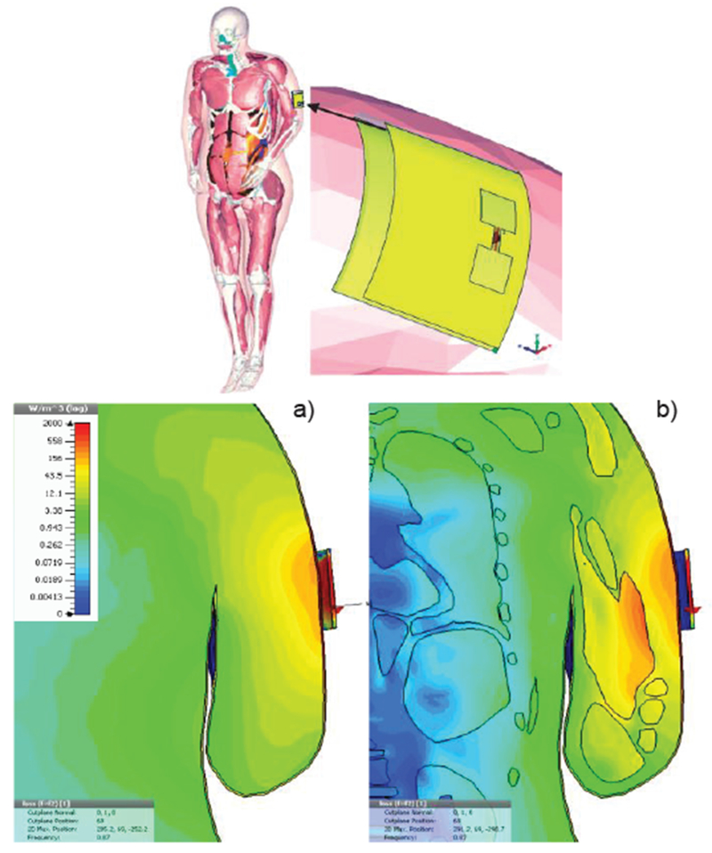 Fig. 22.