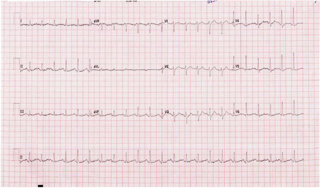 FIGURE 2