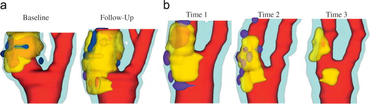 Fig. 10