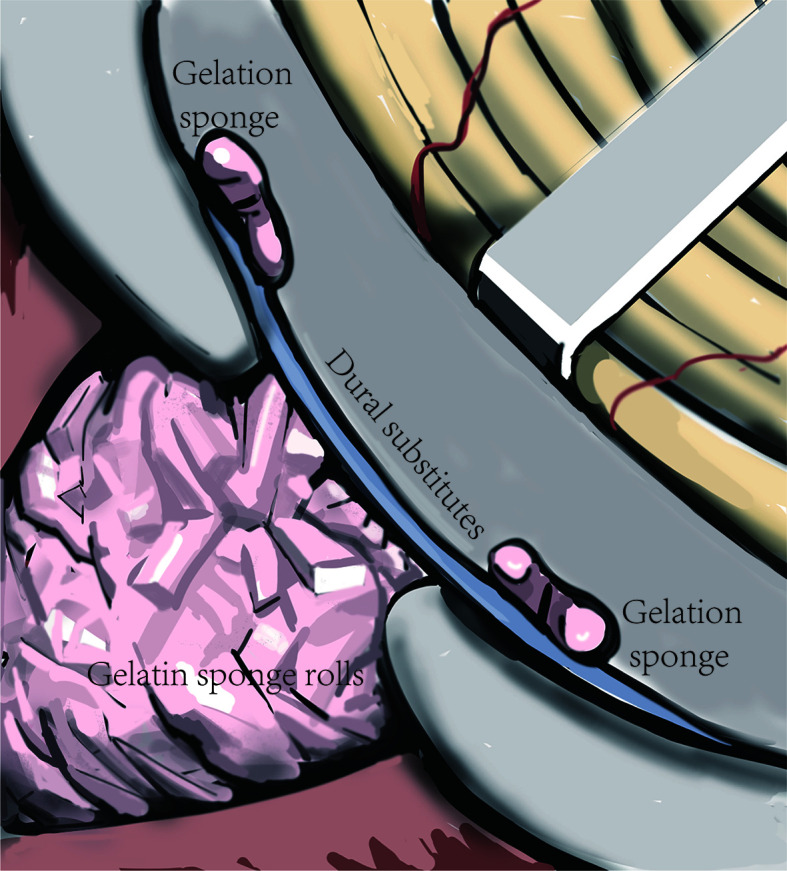 Figure 4