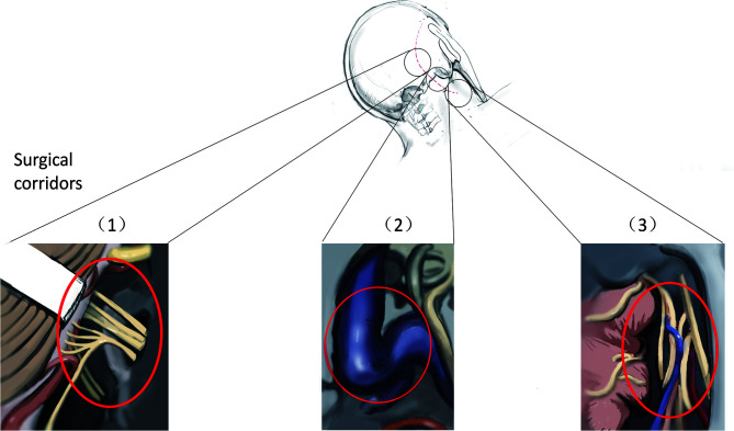 Figure 1