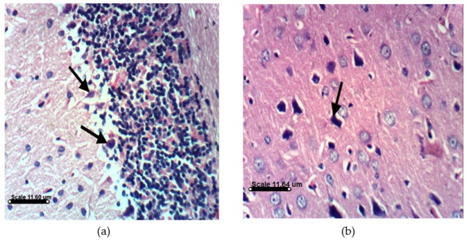 Figure 14