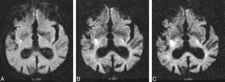 fig 3.