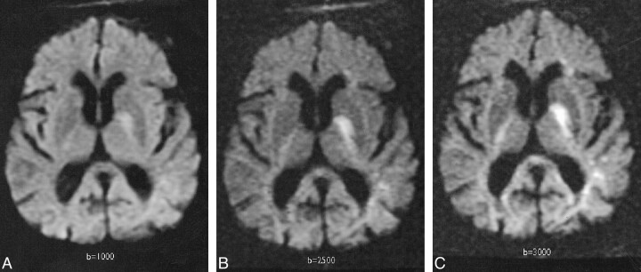 fig 2.