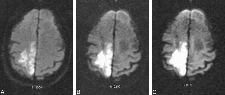 fig 4.