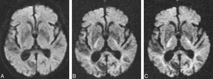 fig 5.