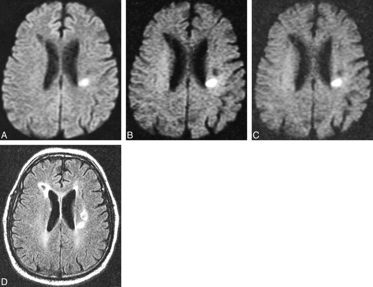 fig 6.