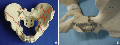 Fig. 2