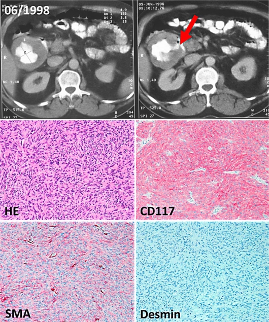 Fig. 1