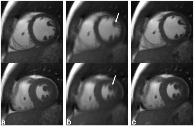 FIG. 5