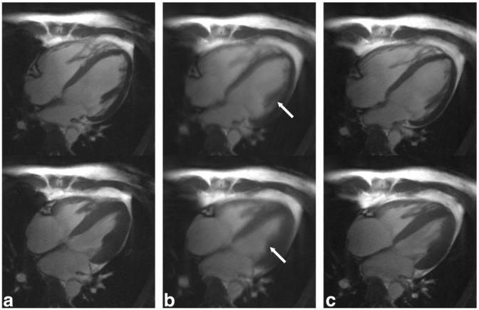 FIG. 6