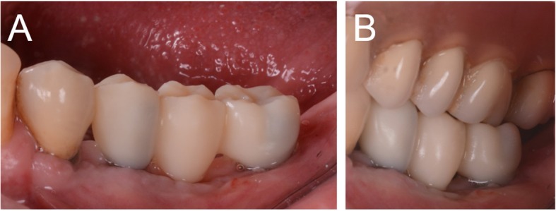 Fig. 9