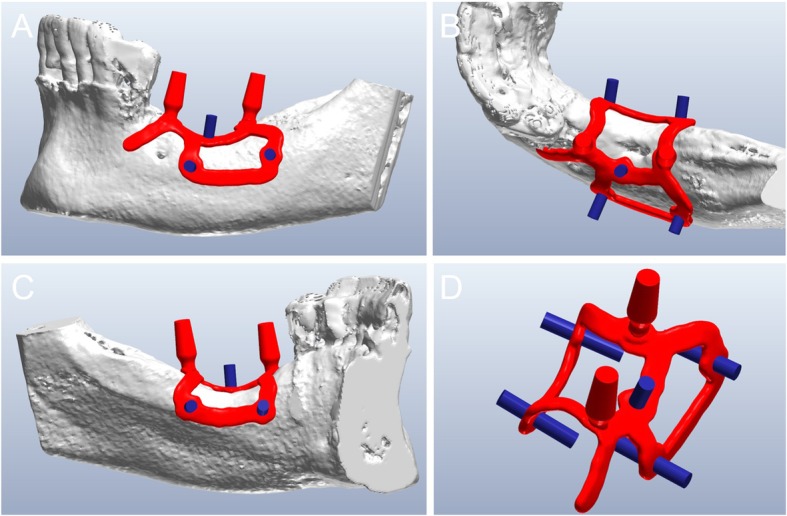 Fig. 3