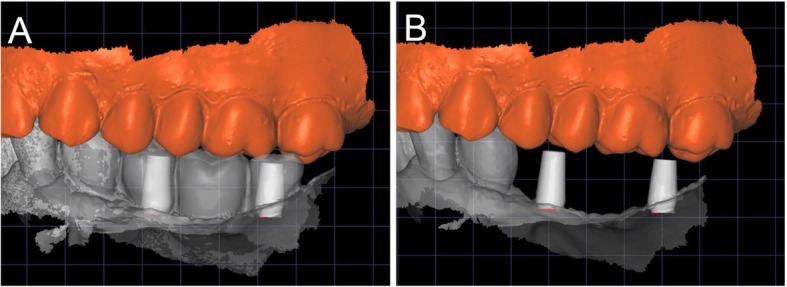 Fig. 12