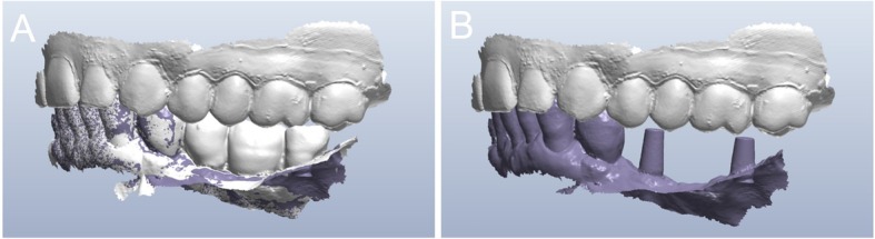 Fig. 11