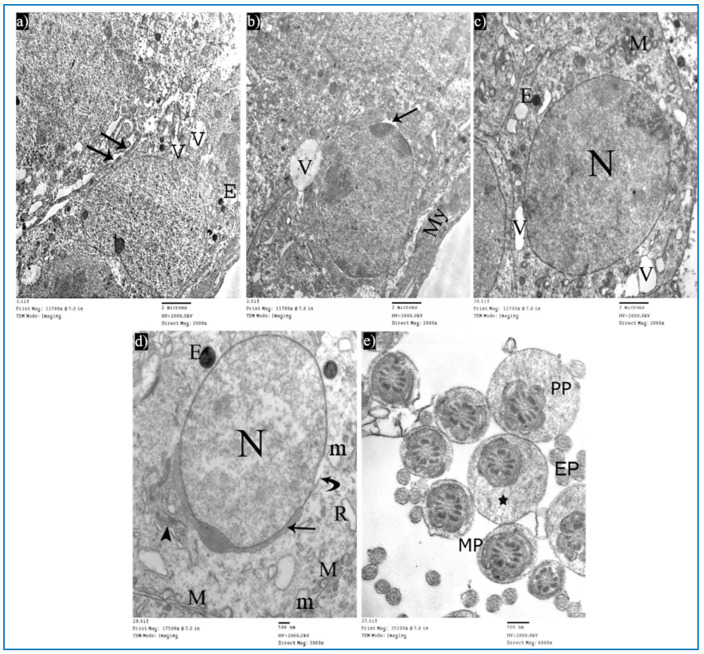 Figure 14