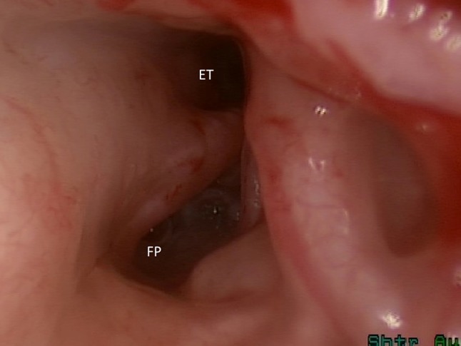 Fig. 7