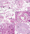 Fig. 11