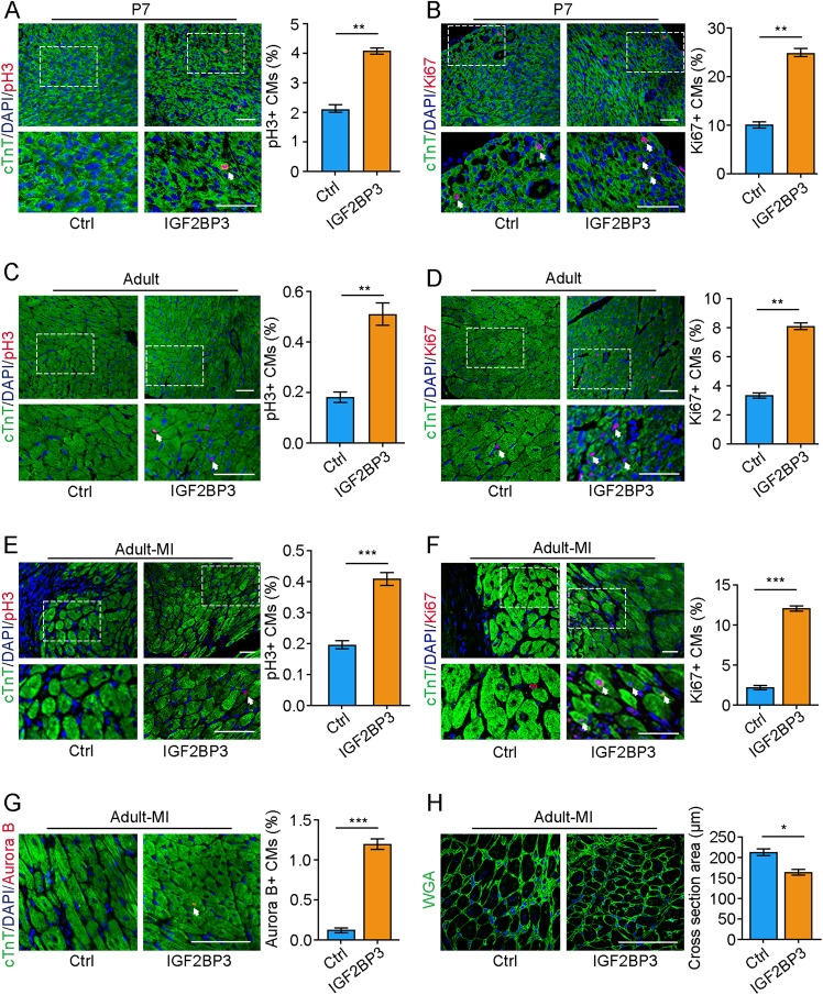 IGF2BP3 promotes adult myocardial regeneration by stabilizing MMP3 mRNA ...