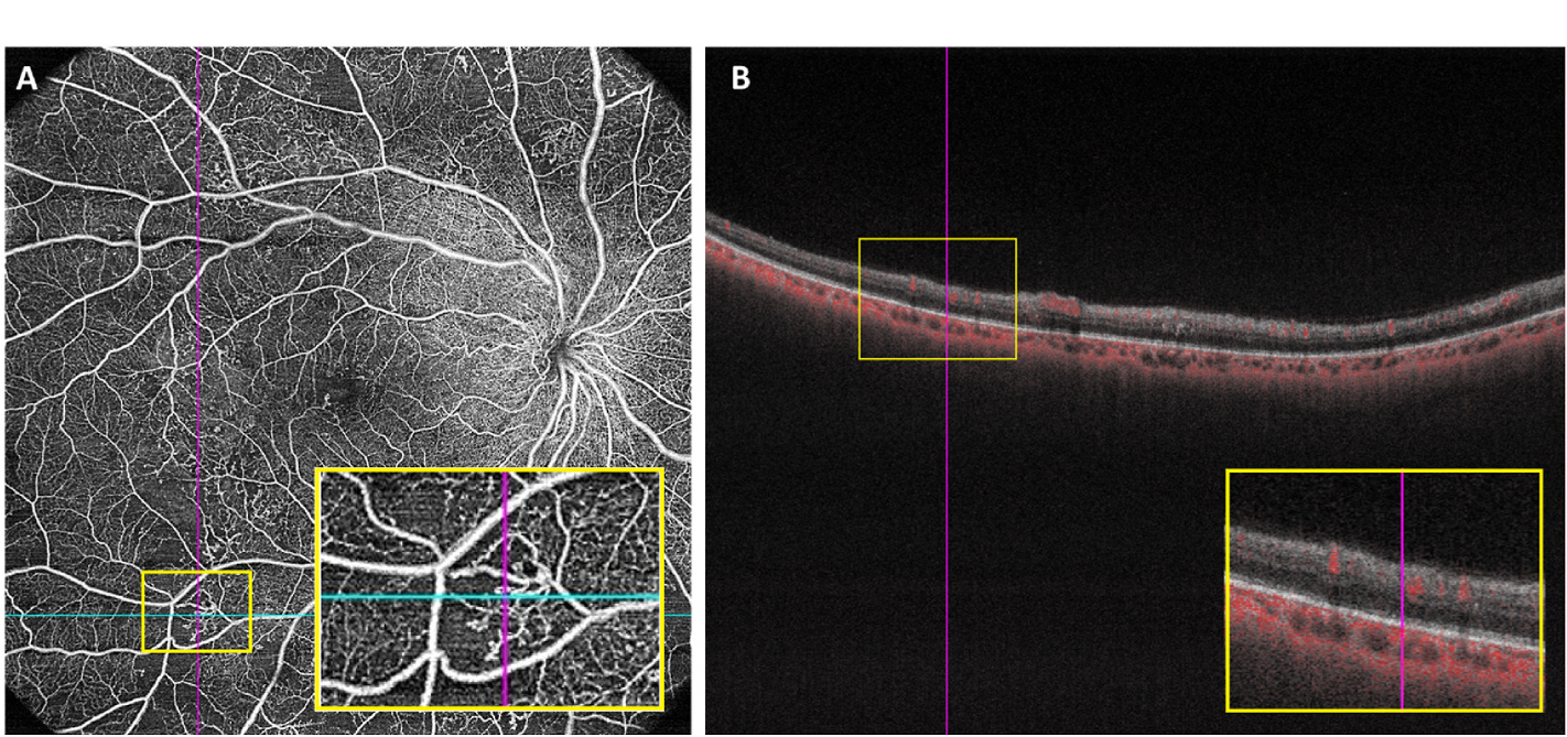 Fig. 6.