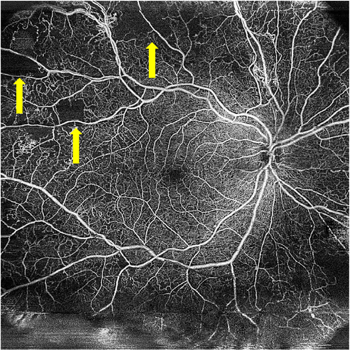 Fig. 4.