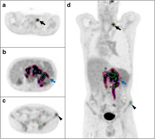 Fig. 8